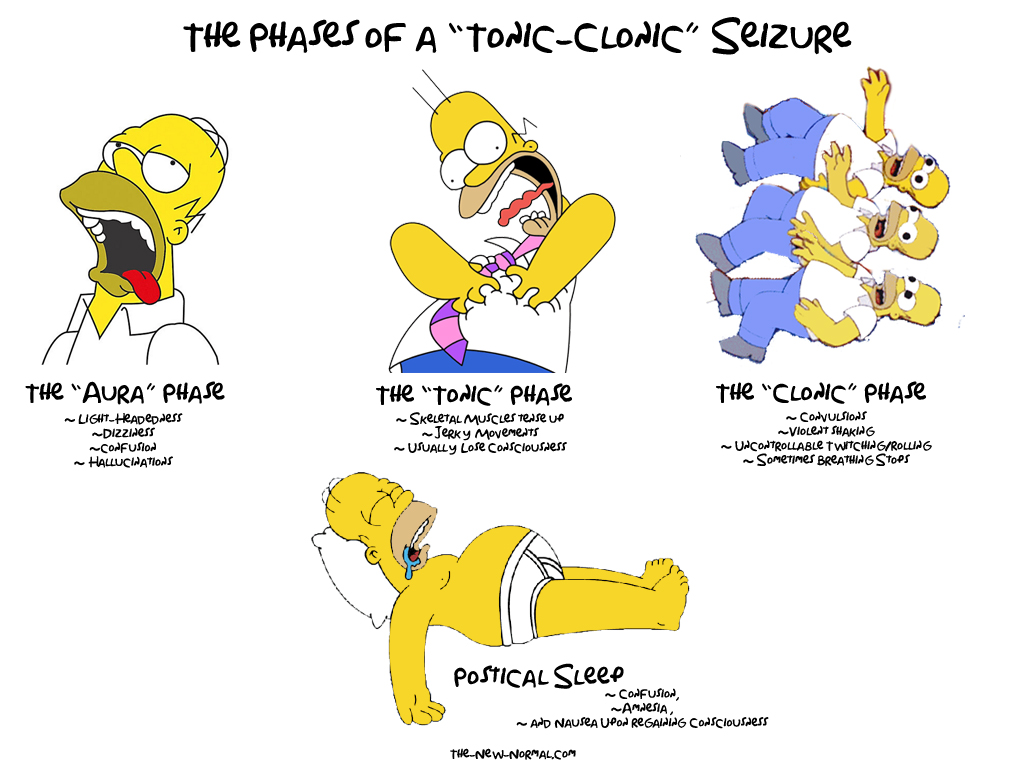 The Phases of a Tonic Clonic Seizure is a funny graphic explaining the seizure with pictures of homer simpson in different positions.